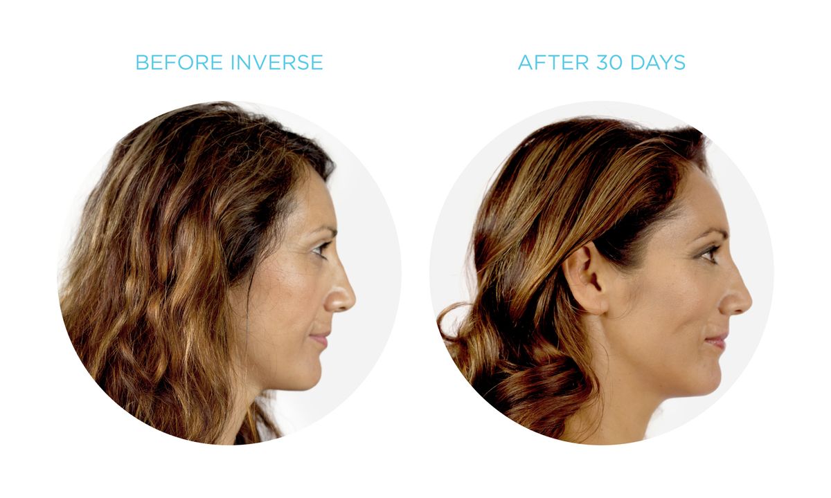 インバースのビフォーアフター写真