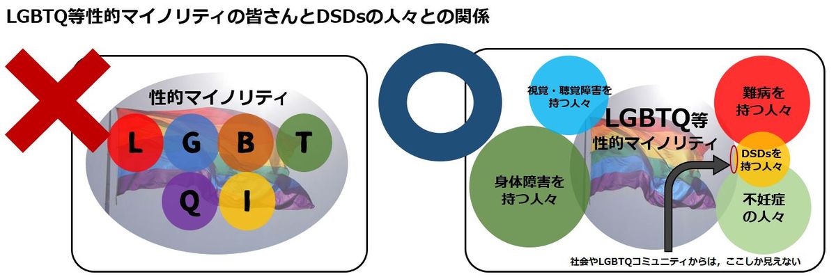 LGBTQ等性的マイノリティの皆さんとDSDsの人々との関係
